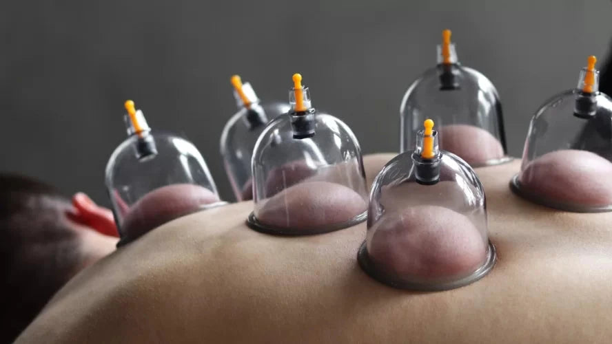 Breathe Again: My Journey with Cupping Therapy for Respiratory Health!