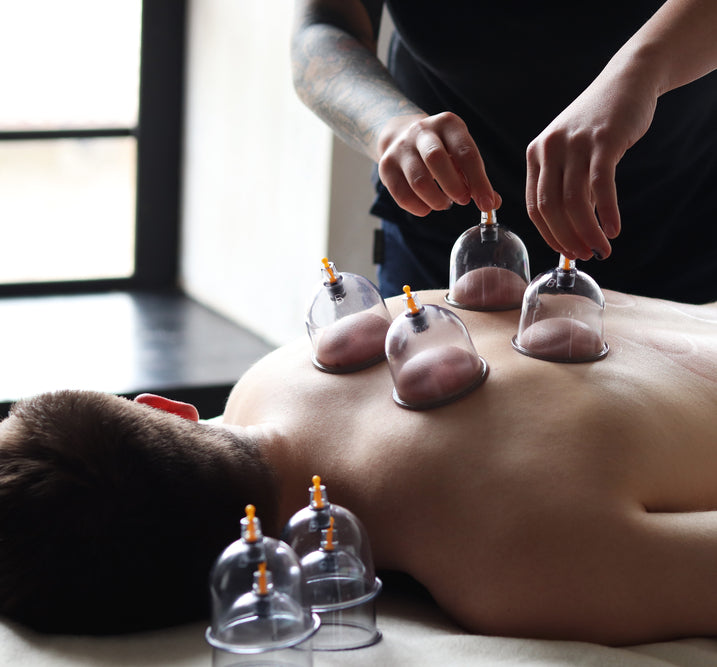 Cupping Therapy (Hijama) Course